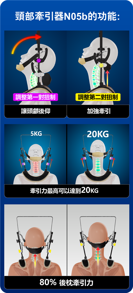 頸椎神經受壓