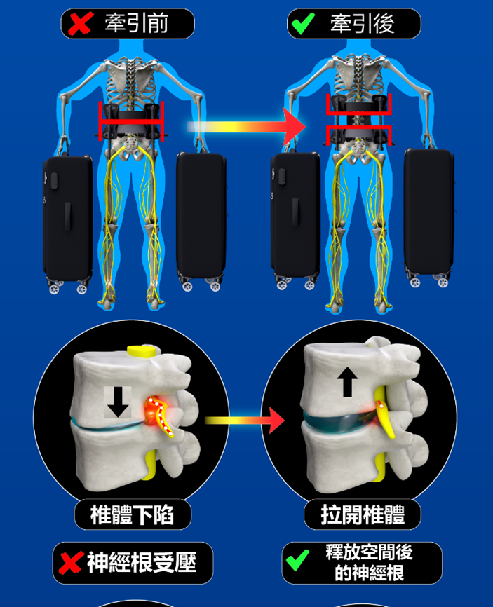 Back Traction Device