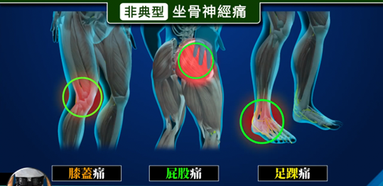 下肢局部疼痛