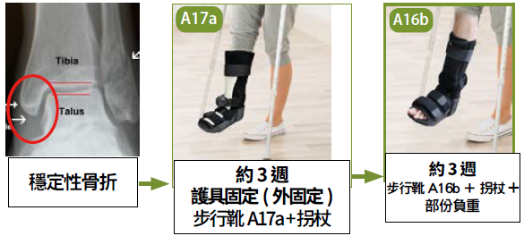 部分負重漸進式復康示意圖